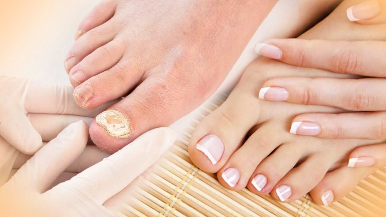 Nails