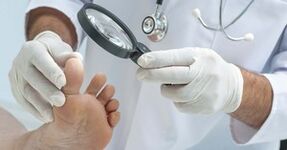 Doctor examines fungal -affected leg