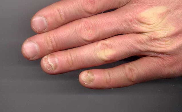 So in the hands